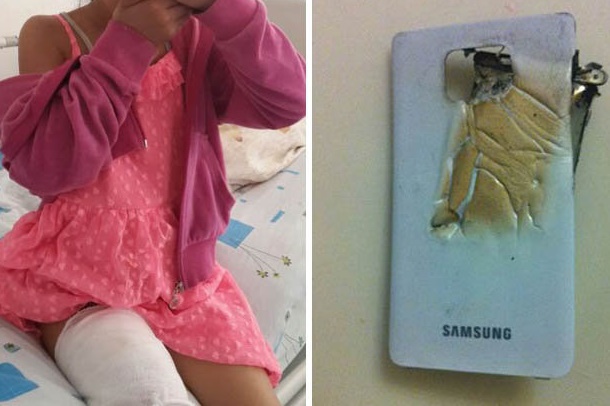 7 year old injured by exploding Galaxy S2