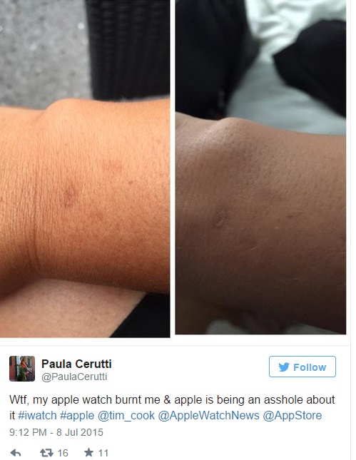 Some Apple Watch users complained about skin irritation upon wearing the device