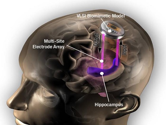 Memory Implantation Process