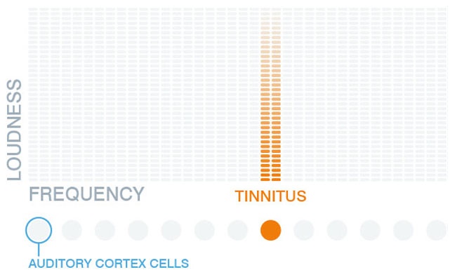Tinnitus Method of treatment with new audio App