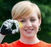 Woman from London Gets World's Most Advanced Bionic Hand Replacement