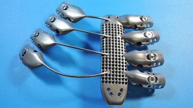World's First 3D-Printed Titanium Rib Cage is simply majestic!