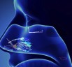 Doctors to adopt 3D modelling technique for future sinus operations